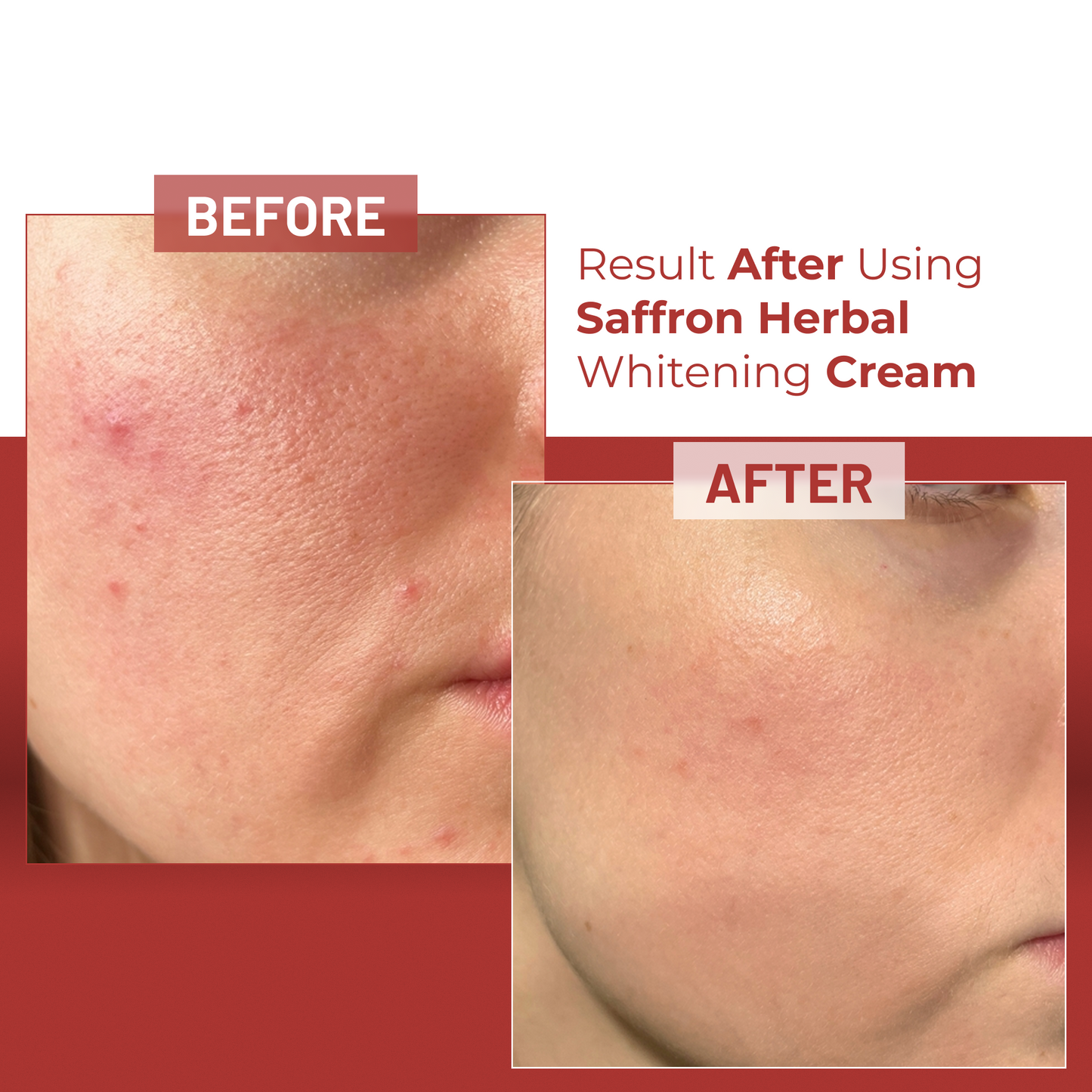 Saffron Herbal Whitening Cream (BUY 2 GET 1 FREE)