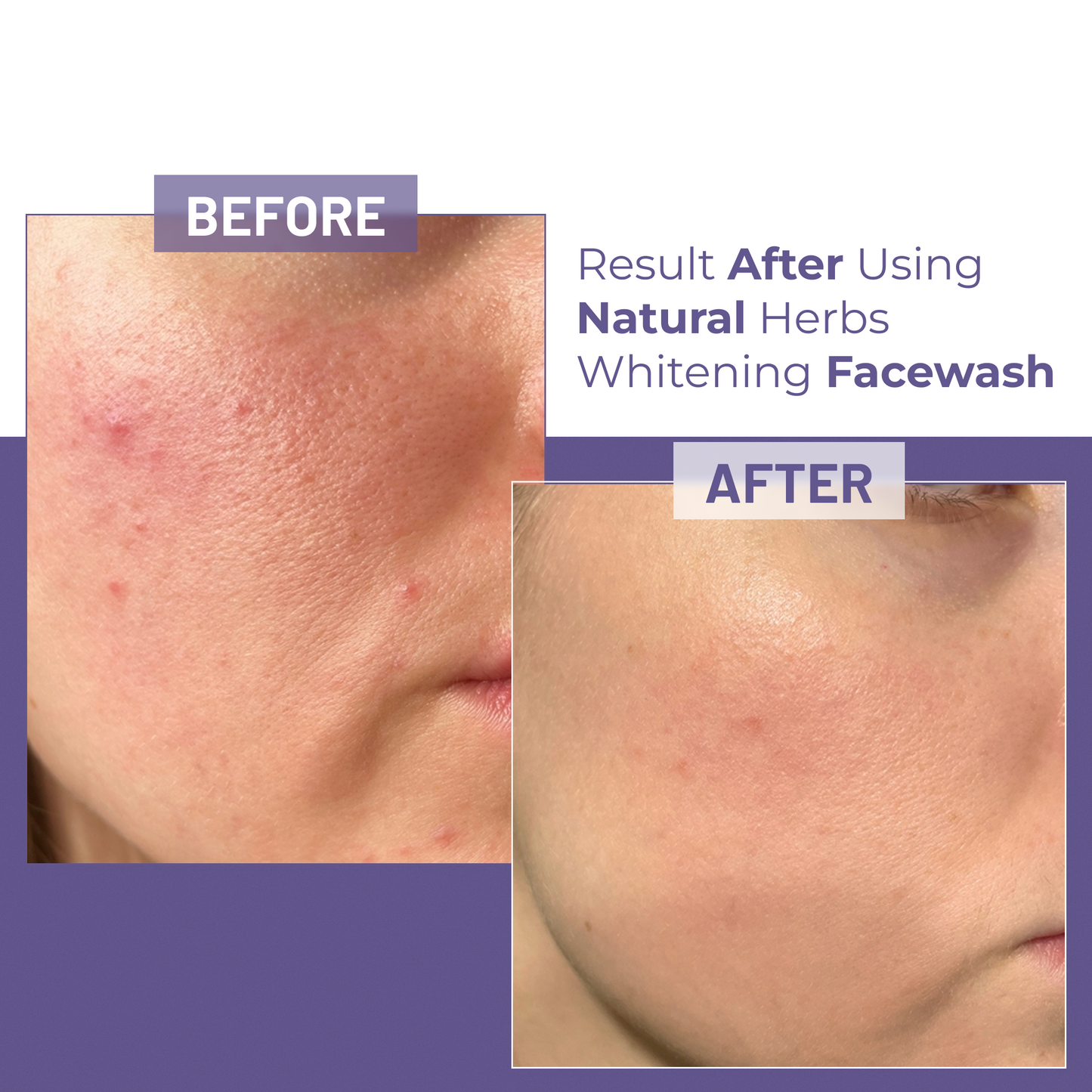 Whitening FaceWash Refresh and Oil Control