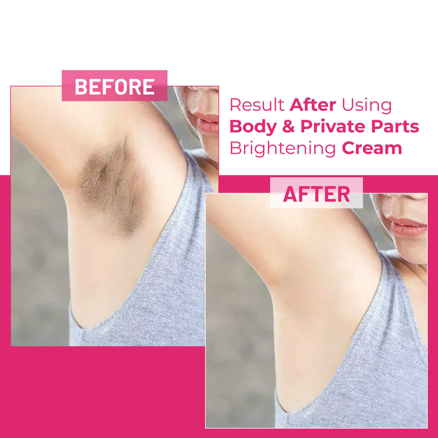 Body & Private Parts Whitening Cream