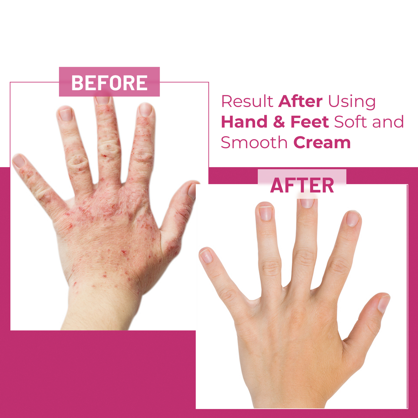 Hand and Feet Whitening Cream