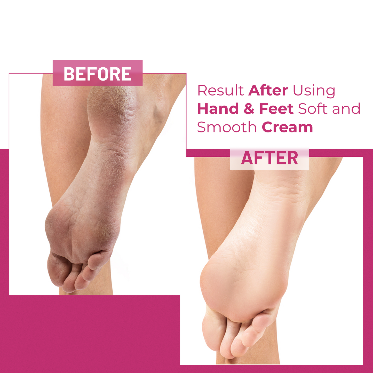 Hand and Feet Whitening Cream