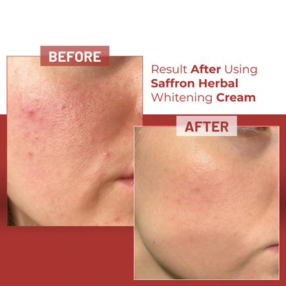 Saffron Herbal Whitening Cream  (BUY 2 GET 1 FREE)